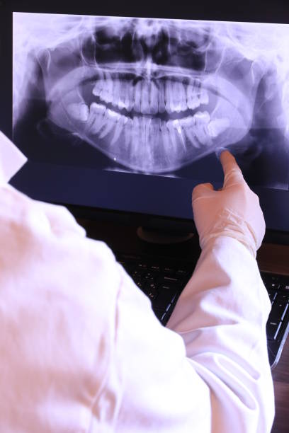 Best Emergency Root Canal Treatment in North Brooksville, FL