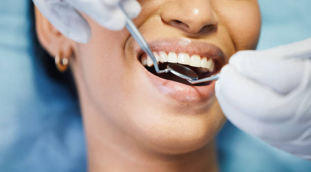 Best Emergency Dentist for Knocked-Out Tooth in North Brooksville, FL