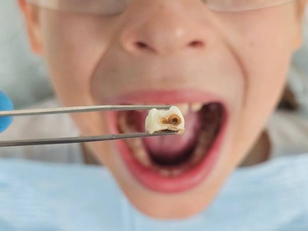 Best Weekend Emergency Dentist in North Brooksville, FL